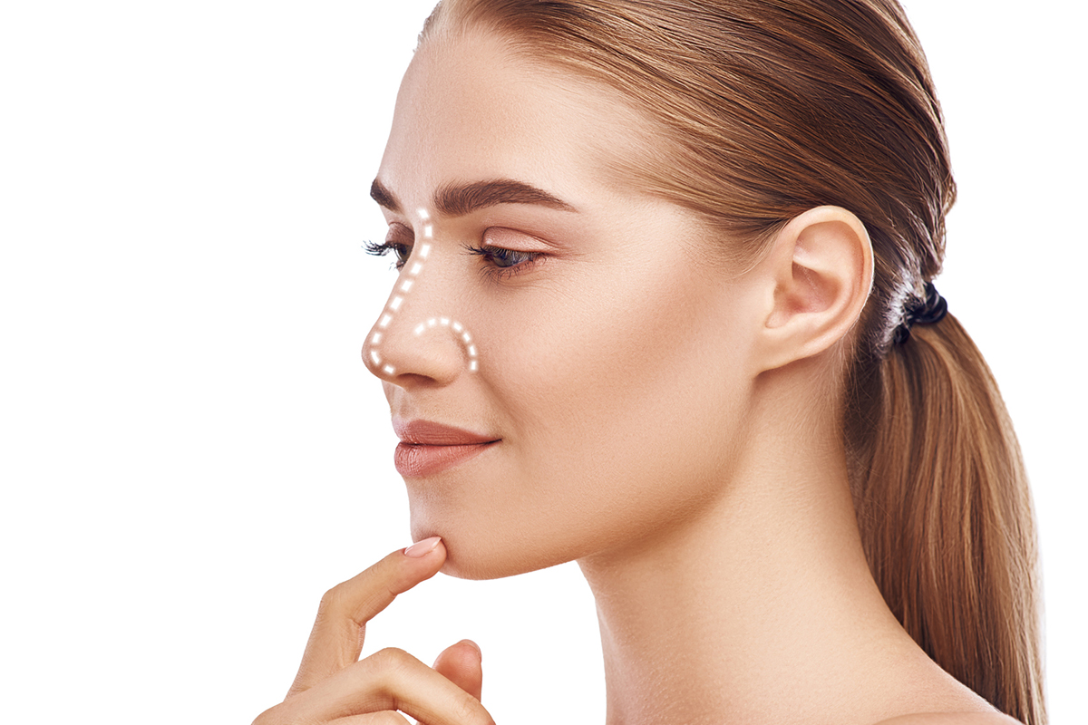 Augmentation Rhinoplasty - Rhinoplasty- Nose Job - Hong Plastic Surgery