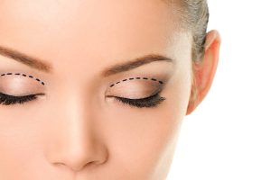 Browlift - Eyelid Lift - Hong Plastic Surgery